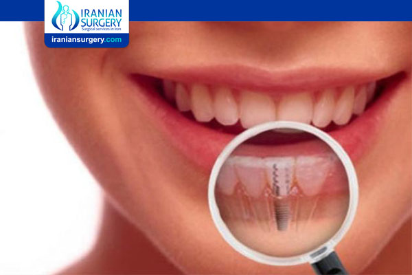 Dental implant Risks