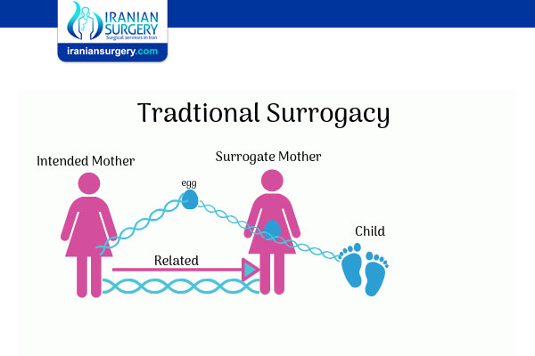 Traditional Surrogacy