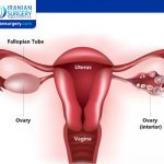 Primary Ovarian Insufficiency Causes