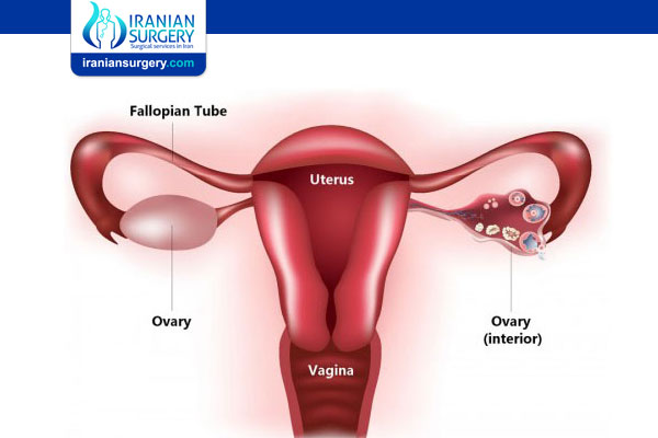 Primary Ovarian Insufficiency Causes