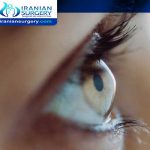 keratoconus Treatment in Iran