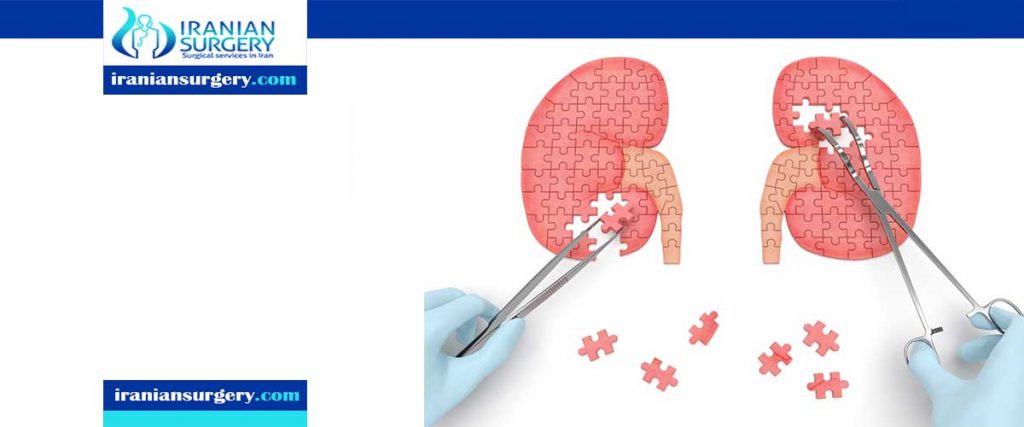 kidney-stones-and-treatment-methods-dornier-medtech-americas