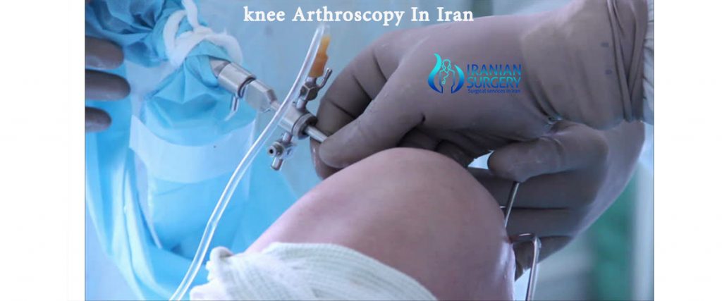 knee arthroscopy Iran cost