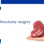 What is laparoscopic nephrectomy surgery