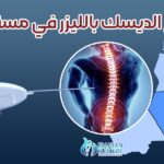 علاج الديسك بالليزر في مسقط