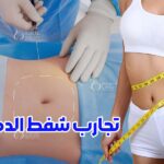 هل یمکن الحمل بعد عملیة نحت الجسم؟