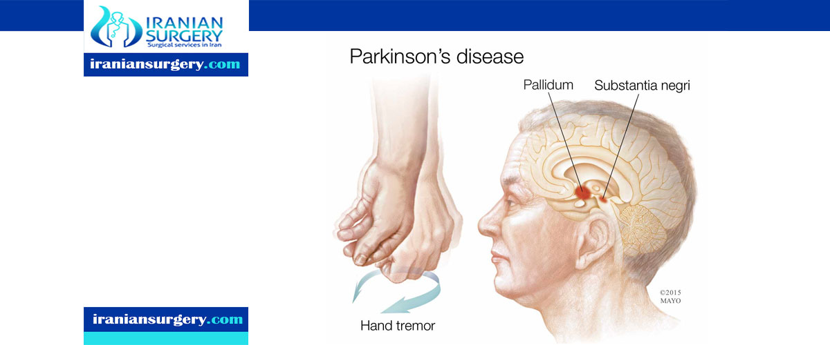 Parkinson disease symptoms