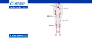 peripheral angioplasty procedure in Iran