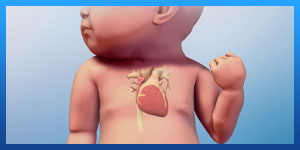 علامات ثقب القلب عند الاطفال