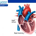 Heart arrhythmia cure