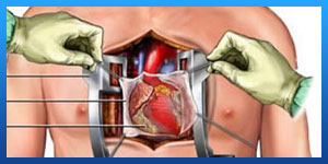 علامات فشل عملية القلب المفتوح