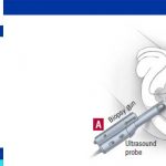 prostate biopsy bleeding