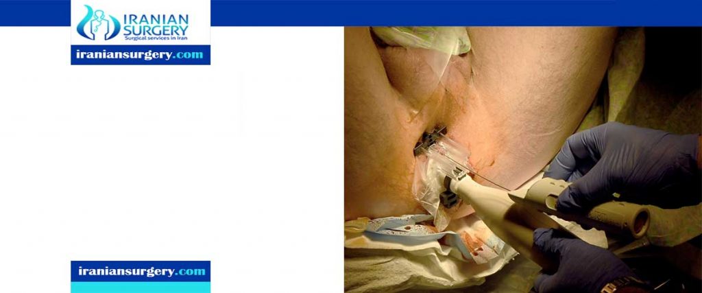 prostate biopsy video procedure