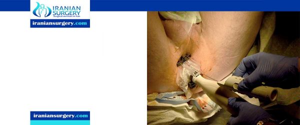 prostate biopsy complications Iranian Surgery