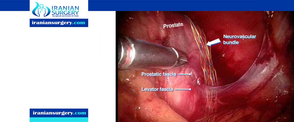 prostate removal surgery name