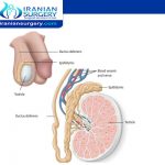 اعراض سرطان المبیض المبکرة