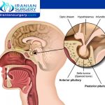 ورم الغدة النخامية