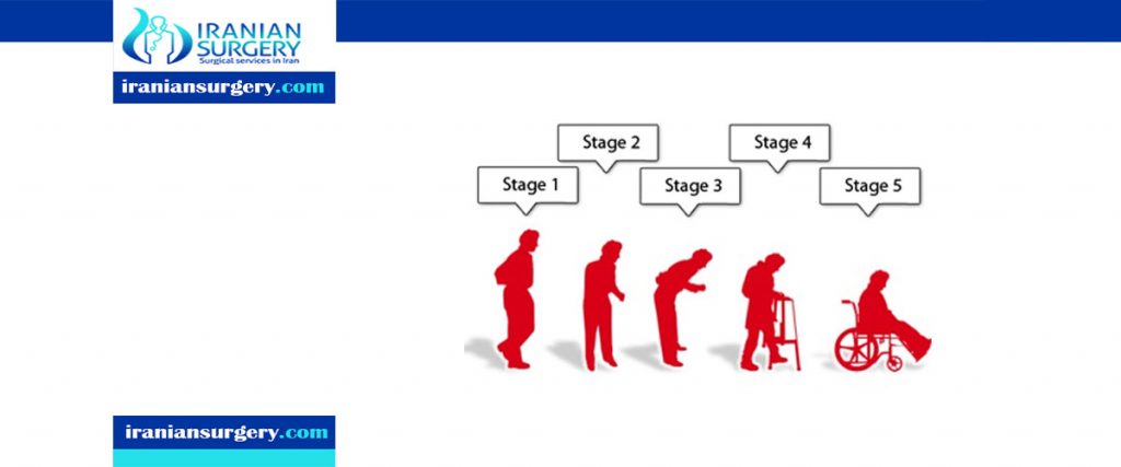 What are the 5 stages of Parkinson disease