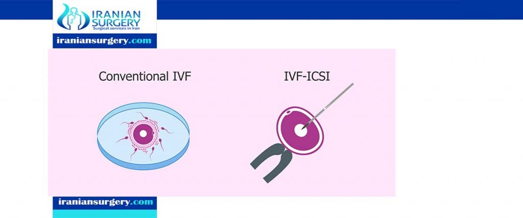 what is the difference between ICSI and IVF