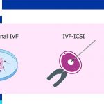 what is the difference between ICSI and IVF