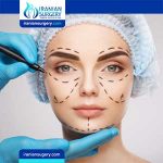 افضل مراکز عملیات تجمیل في ایران