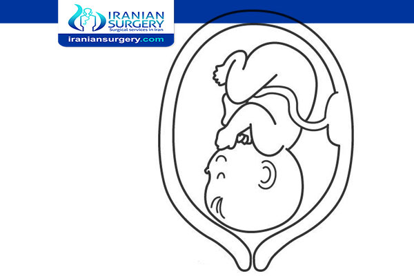 الإجهاض الطبي في ایران