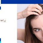 زراعة الشعر للنساء في ایران