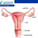 علاج سرطان عنق الرحم