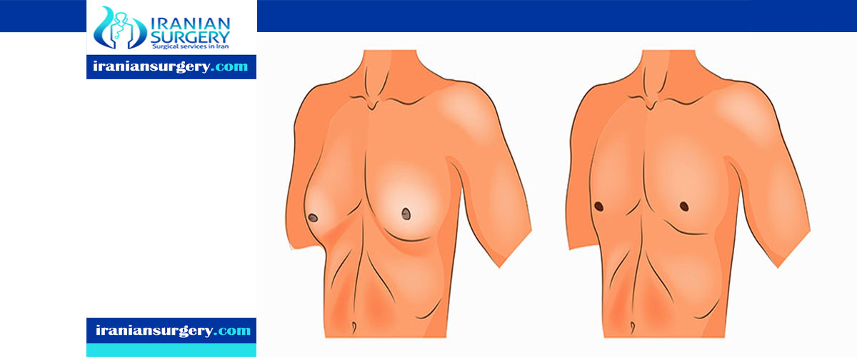 مخاطر التثدي على صحة الرجل